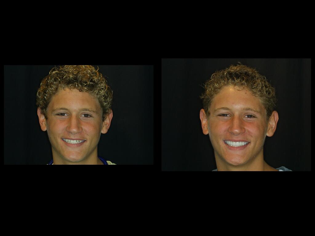 Dental Patient - Before and After Featured Image of the Week