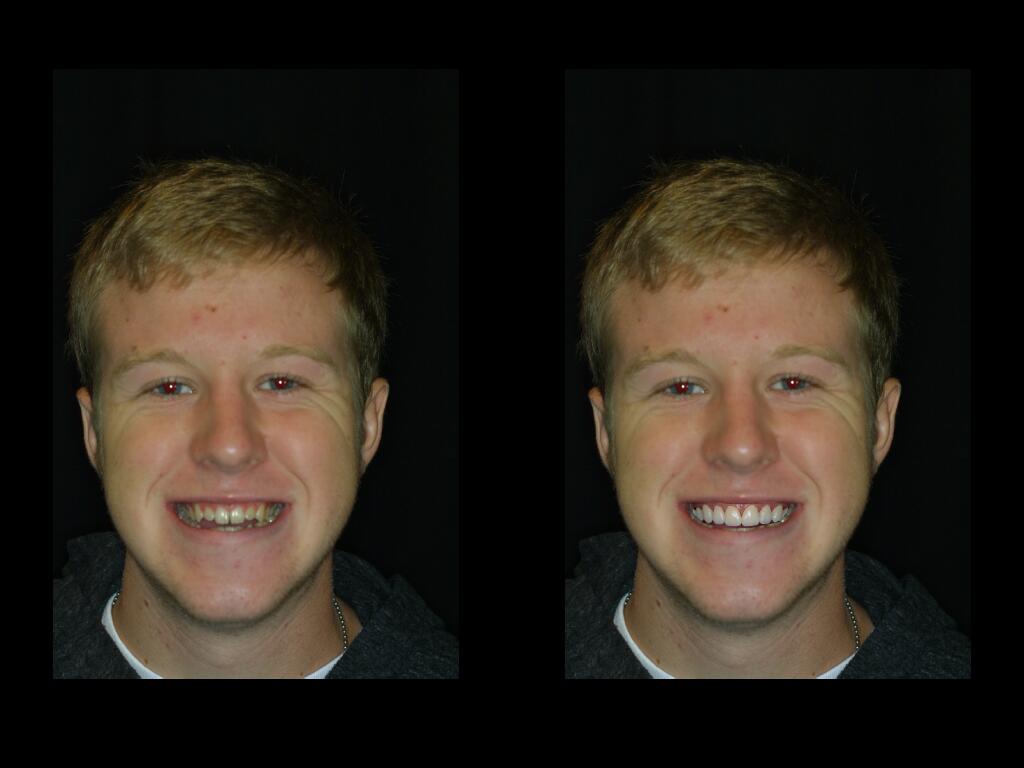 J Gruny Before and After Dental procedure