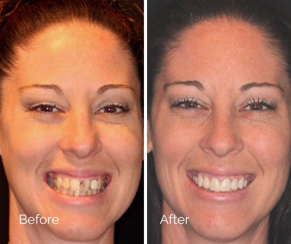 Before and After Dental Treatment