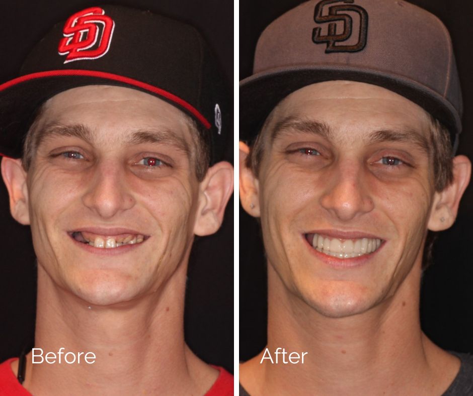 Before and After dental treatment