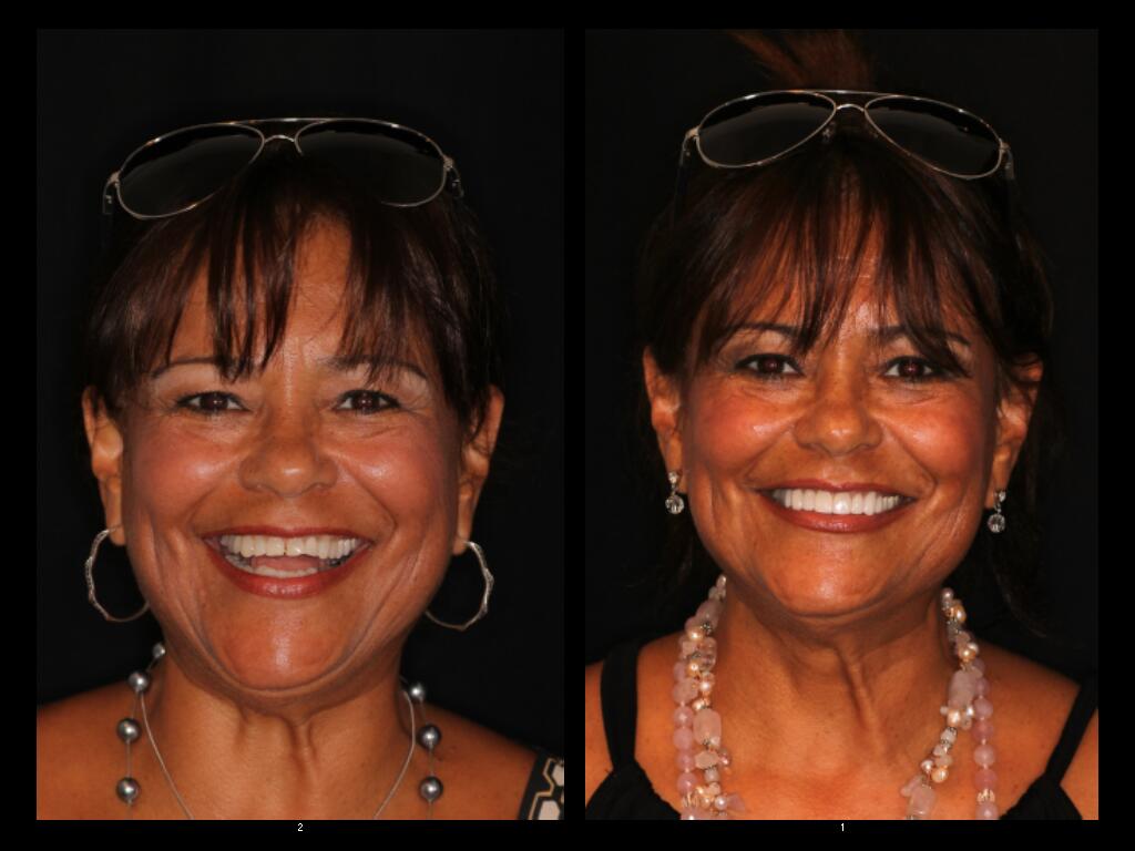 D. Sinnett before and after dental treatment