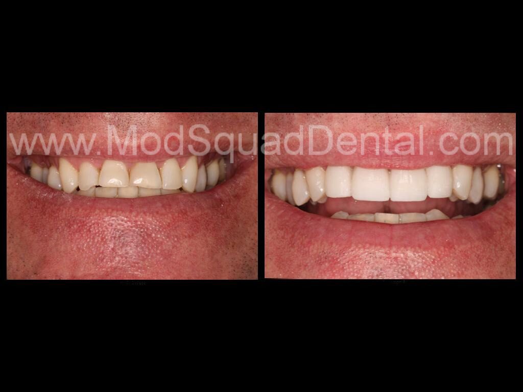 G. Graham before and after dental treatment