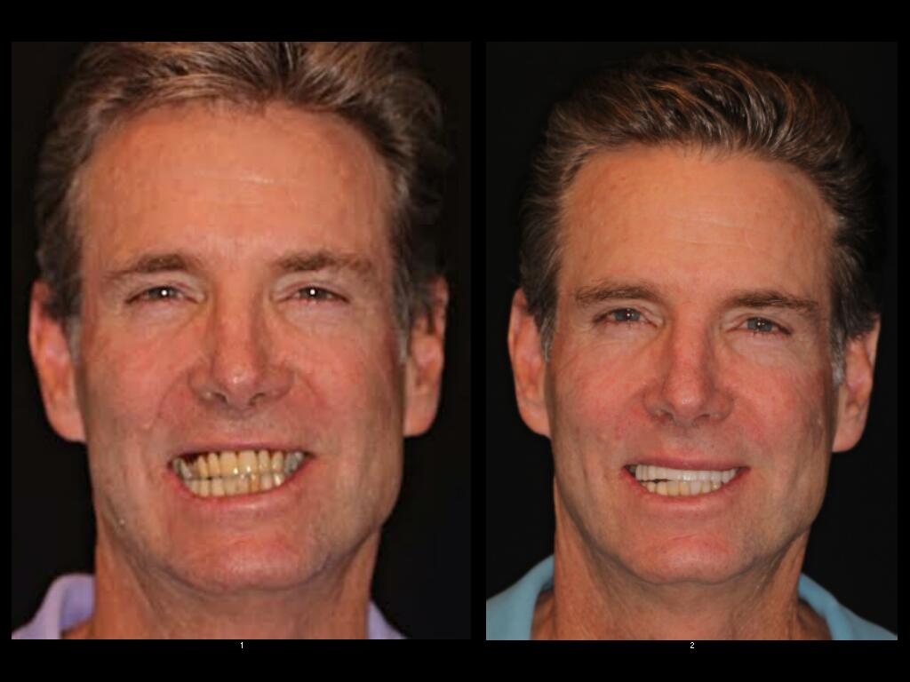 J. Jackson before and after dental treatment
