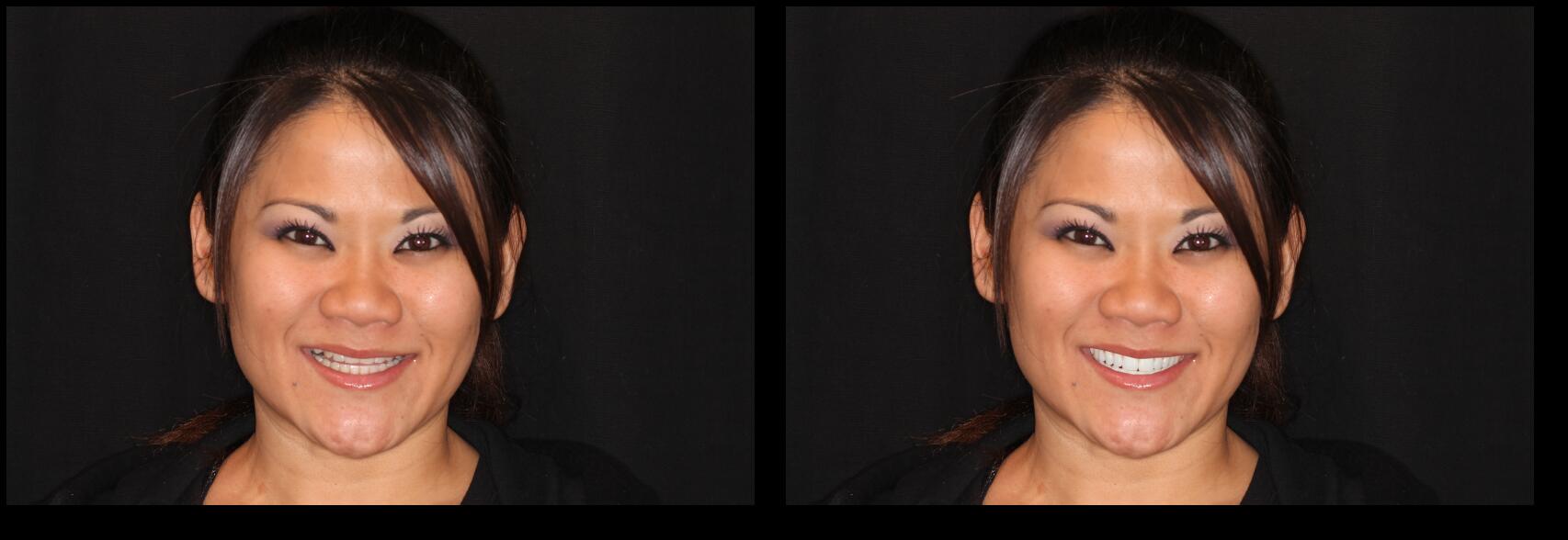 KKoshimizu before and after dental treatment