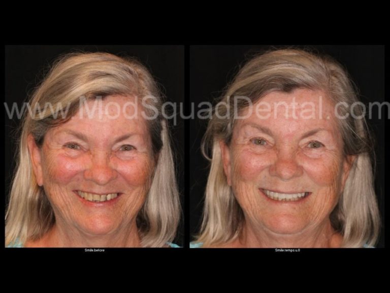 Dental ReconstructionMOD Squad Dental MOD Squad Dental