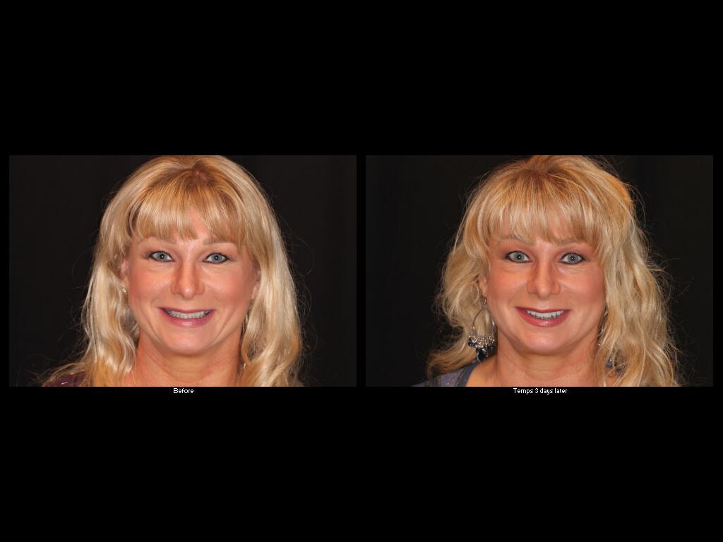 S. Robinson Before and After dental treatment