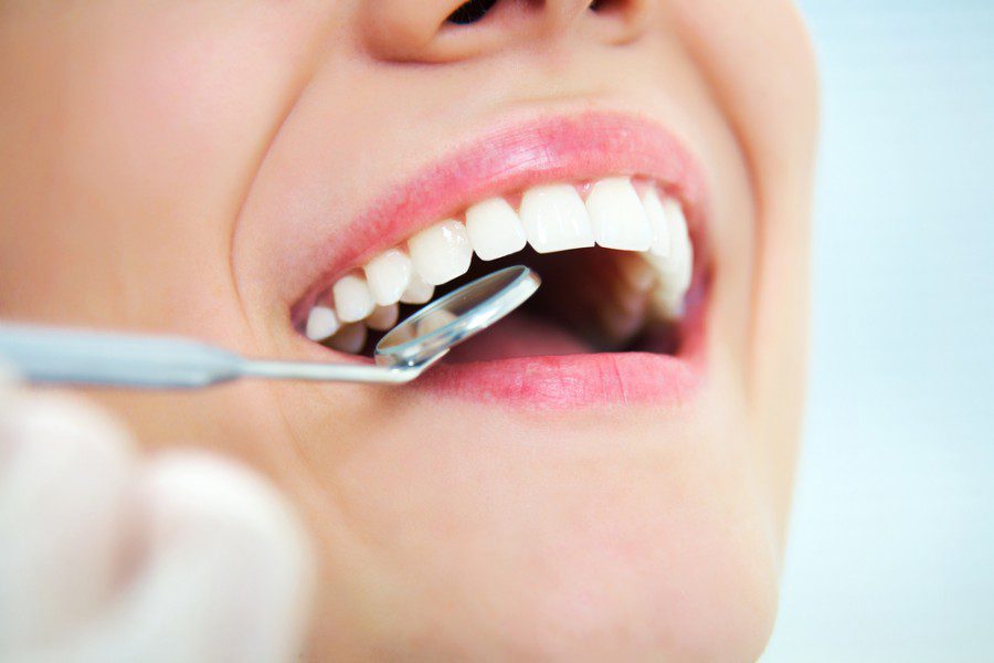 Dental Exam - MOD Squad Dental