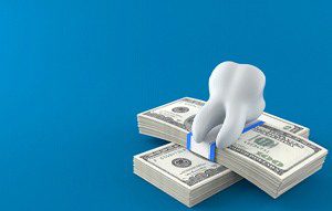 Understanding the cost of full mouth reconstruction