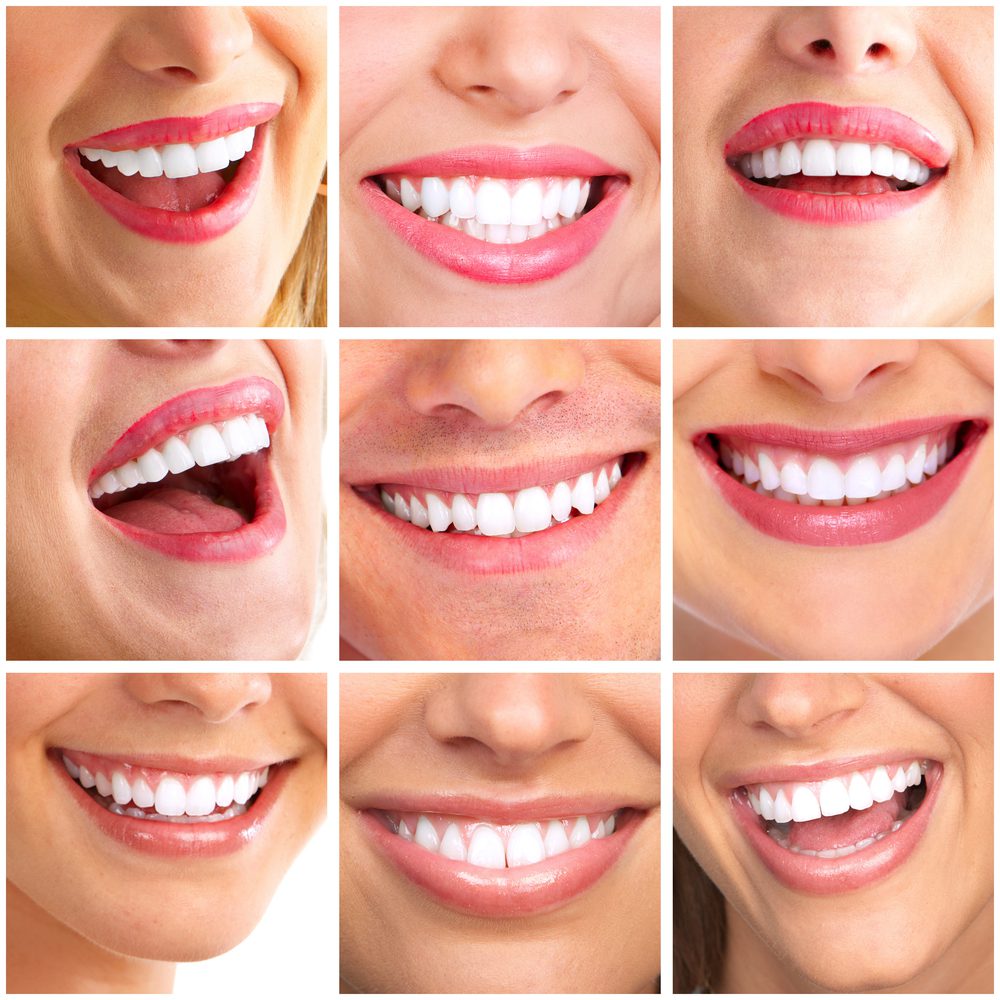 Smile Collage