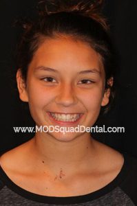 Picture of a young kid that is for dental procedure