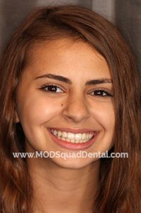 Natalia- Patients for Ortho Dentistry